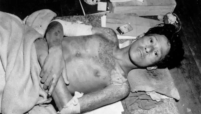 Nagasaki'nin 80 Yıl Sonra Gelen Uyarısı: Nükleer Tehdit Yeniden Gündemde