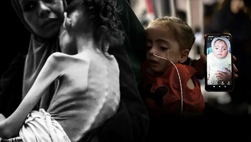 25 Kilodan 10 Kiloya Düşen Meryem’in Zorlu Mücadelesi