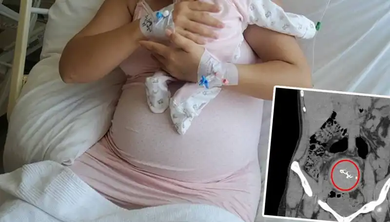 Doğumda Gazlı Bez Unutuldu: İki Yıl Sonra Sıra Dışı Gelişme!